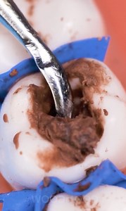 40K views · 161 reactions | Dentist Visits Explained Without The Scary Stuff! | Transformazing | Facebook