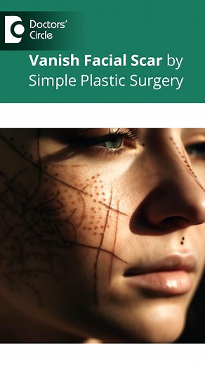 VANISH FACIAL SCARS | Facial Scar removal by Plastic Surgery #facialscars #scars #plasticsurgery | Doctors' Circle