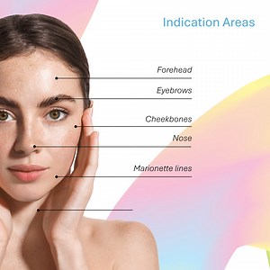 Transform your entire face with Aptos Thread Lifting! Revitalized and lifted appearance from every angle! 💧✨ | Aptos