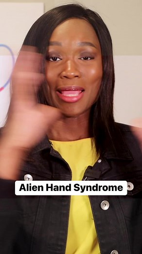 18 reactions | Alien hand syndrome is a phenomenon in which one hand is not under control of the mind. The person loses control of the hand, and it acts as if it has a mind of its own. It could be caused by some kind of damage to the brain #alienhandsyndrome #checkwithdoctoro | Check with Doctor O | Facebook