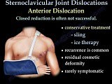 Sternoclavicular Dislocation Injuries - Video Lecture • Video • MEDtube.net