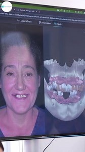 1.5K views · 24 reactions | 푺풎풊풍풆푪풍풐풖풅 - 푻풆풉풏풐풍풐품풊풆 풅풆풏풕풂풓풂̆ 풅풆...