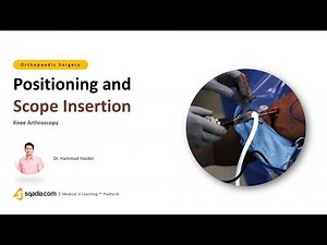 Knee Arthroscopy | Positioning and Scope Insertion | Orthopedic Surgery Video | V-Learning