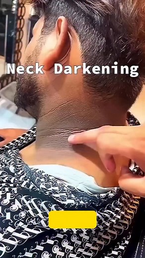 129K views · 6.7K reactions | Neck tan? For more info follow @factsbybujji #factsbybujji #kannadafacts #nammafactsinkamnada #karnataka #bengaluru #colourskannada #mysuru #dailyfacts #factsdaily #virals #yash #dboss #kicchasudeep #goldenstarganesh #rashmika #saptami #ashikarangnath #belgavi #balari #hubli #darward #kengeri #ramanagara #magadi #bidadi #tan #reel | Factsbybujji Bujji | Facebook