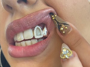 Double Tooth Caps Grillz With Iced Out Diamond Window! Moissanite VVS - Etsy