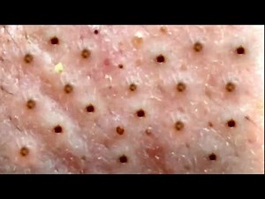 Satisfying and Comfortable with An Spa's videos #003