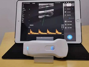 [Hot Item] Vascular Imaging Color Doppler Probe Ultrasound Imaging in a Handheld Device Portable Ultrasound Scanner