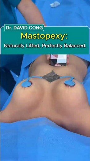 Mastopexy: Naturally Lifted, Perfectly Balanced.| Dr David Cong