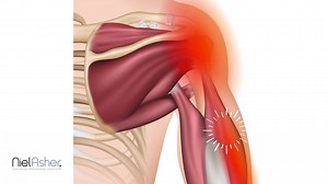 Teres Minor - Trigger Point Anatomy http://bit.ly/2Rkd6ud | NAT Global Campus