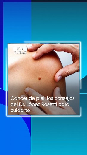29K views · 28 reactions |  El cáncer de piel es uno de los más comunes. Se puede prevenir y, si lo detectás a tiempo, hasta curarlo. ‍⚕️ El Dr López Rosetti te cuenta cómo hacerlo. #TelefeNoticias #cancer #cancerdepiel #melanoma #lunar | Telefe Noticias | Facebook