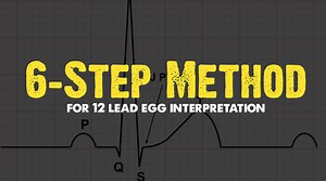 6-Step Method for 12-Lead ECG Interpretation
