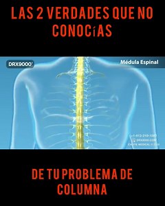 17 reactions · 57 shares | Estos 2 ejercicios al final del video te ayudaran a quitar los molestos síntomas de la columna cervical , Dale like y comparte agenda tu cita WhatsApp 313 2058681 #elmedicodelpueblo #ajustandocolumnas #tratamientovertebral #dolordeespalda #nervioCiatico | Quiromasters Colombia | Facebook