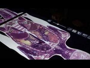 Anatomy Teaching at University of Birmingham: Anatomage Table