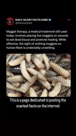 Thescaryfact ™ on Instagram: "Maggot therapy, a medical treatment still used today, involves placing live maggots on wounds to consume dead tissue and promote healing. While effective, the sight of writhing maggots on human flesh can be undeniably unsettling. This therapy uses sterile, lab-grown maggots, typically from the green bottle fly species. These maggots selectively eat necrotic (dead) tissue while leaving healthy tissue unharmed. They also secrete substances that help disinfect the woun