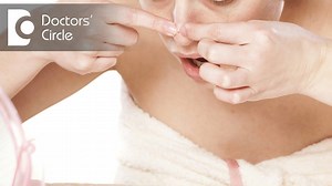 How to differentiate between Boils, Abscesses & Carbuncles? | Doctors' Circle