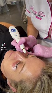 Plasma Fibroblast Fibroblast is a procedure which requires zero surgery. It is a non-surgical, non invasive treatment that is designed to tighten and lift the skin, shrinking excess skin. Send us a DM for all prices | Skin Lab Beauty Clinic | Facebook
