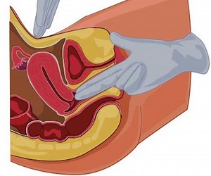 Pelvic Exam III: Bimanual and Rectovaginal Exam