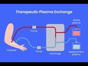 Plasmapheresis therapy Or plasma exchange ; Definition, Procedure, Uses, Advantages
