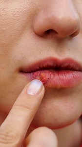 9.7M views · 1K reactions | 26 TRUCOS DE BELLEZA INVALUABLES PARA TU PIEL: | Ideas en 5 minutos Jóvenes | Facebook