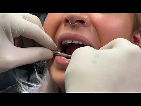 Frenulum piercing INSTRUCTIONAL how to pierce properly