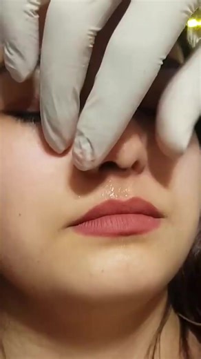 Septum Piercing Procedure #septumpiercing #septumpiercings #septumpiercingsbelike #education #piercingeducation #piercingcare piercing.world | piercing.world
