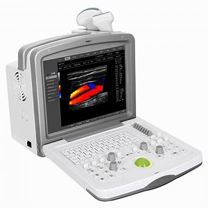 [Hot Item] (MS-C5500) Cardiac/Vascular/Ob/Gyn Portable 3D 4D Echo Color Doppler Ultrasound Scanner