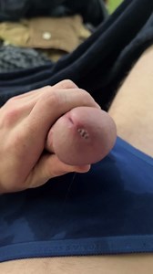 Meatotomy my split penis jerk