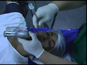 anesthesia, mask ventillation, ET intubation