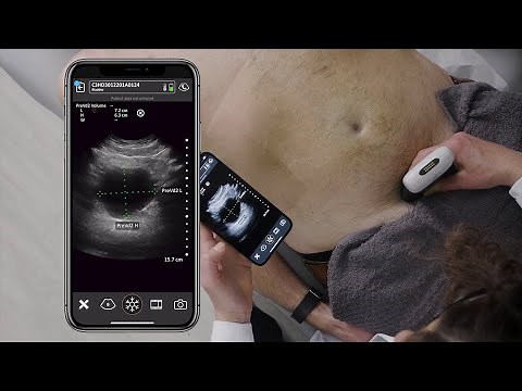 Scanning the Bladder