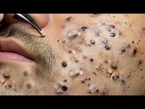 𝑺𝒐𝒐𝒕𝒉𝒊𝒏𝒈 𝑭𝒂𝒄𝒊𝒂𝒍 𝑻𝒓𝒆𝒂𝒕𝒎𝒆𝒏𝒕 𝑭𝒐𝒓 𝑺𝒕𝒓𝒆𝒔𝒔 𝑹𝒆𝒍𝒊𝒆𝒇 𝒂𝒕 𝑳𝒖𝒙𝒖𝒓𝒚 𝑺𝒑𝒂 𝑨𝒄𝒉𝒊𝒆𝒗𝒆 𝑰𝒏𝒏𝒆𝒓 𝑷𝒆𝒂𝒄𝒆 #2632521