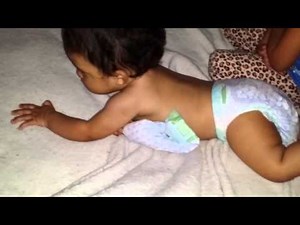 9 month old with Global Developmental Delay