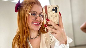 Influencer left with horror burns to face after pressure cooker explosion