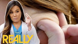 29 year old Lattyse struggles with migraines and immense head pain resonating from the dermoid cyst above her eyebrow she’s had since birth, as things get worse for her and with nowhere to turn Lattyse enlists the help of Dr Lee to remove this hinderance and help her retrieve her self esteem. Dr. Pimple Popper 1310 #pimple #popper #drpimplepopper #drsandralee | Pimple Daily Post