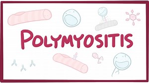 Polymyositis: Video, Causes, & Meaning | Osmosis