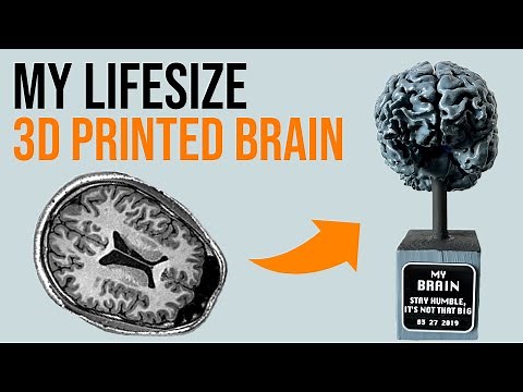 Ultra-Detailed 3D Printed Life Sized Brain From An MRI Scan