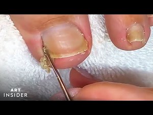 How to Clean Toe Nails