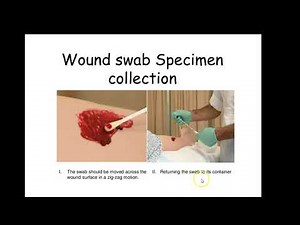 pus sample collection and transport