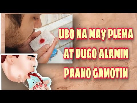 Ubo na may plema at dugo paano gamotin | how to cure bloody phlegm | bloody sputum.