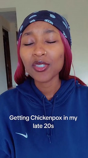 Getting Chickenpox in My Late 20s