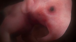 He may have a little while longer before he's born, but this little elephant is already developing some of his most important features 🐘 Don't miss the premiere of #InTheWombAnimalBabies, tonight at 9/8c on National Geographic. | National Geographic TV