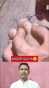 CABUT DURI DI DALAM DAGING ||401 #fyp #short #shorts #feedshorts #trending #viral #splinter