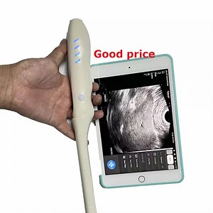 [Hot Item] Wireless Mini Ultrasound Probe (Transvaginal) Transducer, Handheld Plam Ultrasound