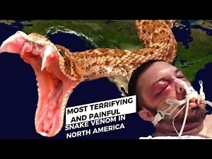 10 Most Terrifying and Painful Venomous Snake Bites In North America 🐍