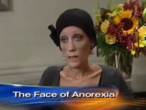 anorexia.wmv