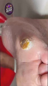 Easy Strategies for Staying Active Comfortably 💖 #ActiveLiving #DailyEase #MoveWell | NC State Wolfpack on TheWolfpacker.com