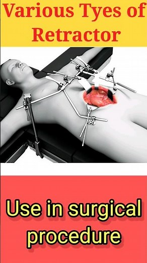 Instrument of the Day. Surgical Retractors, Types. #surgicalinstruments #viral #education #neet