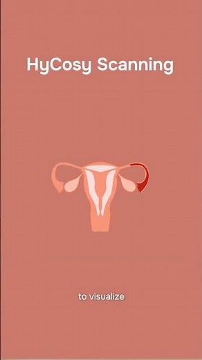 What Is a HyCoSy Scan? Scan Explained!