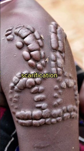 Unveiling Scarification in African Cultures: Exploring Identity, Tradition, and Meaning.