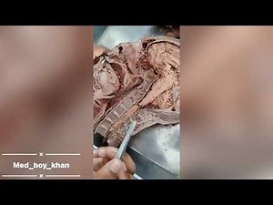 Hemisection details #mbbs #1st prof #anatomy