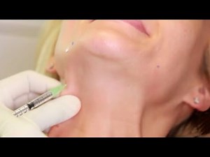 Hablamos de los beneficios del botox